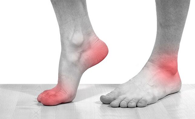 pain in the ankle joints in arthrosis