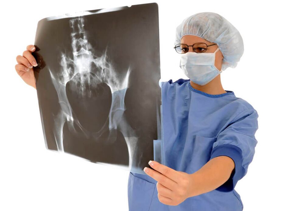 X-rays of the hip joint help the doctor determine the cause of the pain