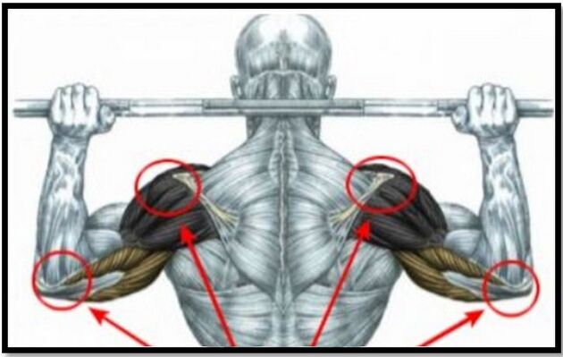 The strain on the muscles of the shoulder and elbow is one of the causes of arthrosis of the shoulder joint