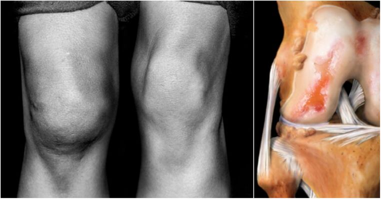 The knee joint and sore joint joint joint