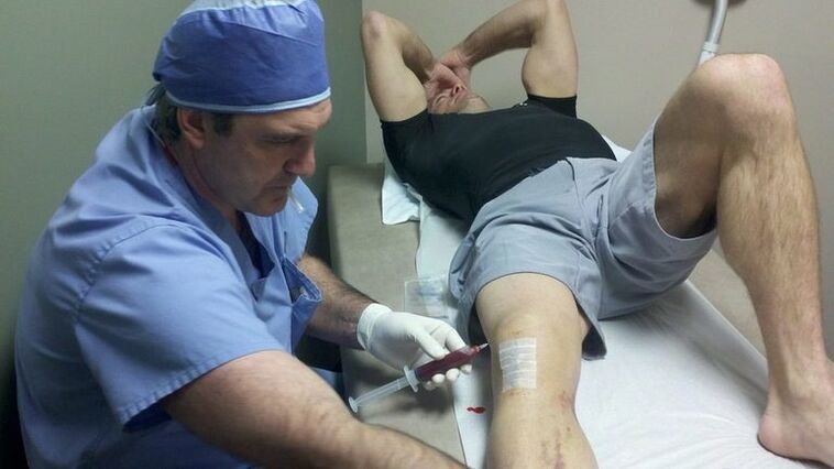 Treatment of the joint joint of the knee joint