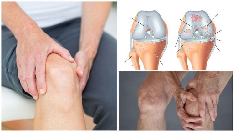 a symptom of knee pain in the joint joint of the knee joint