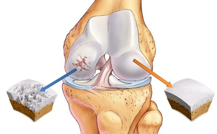 normal cartilage and joint